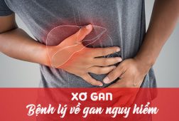 Phác Đồ Mới Nhất Đem Lại Niềm Tin Cho Bệnh Nhân Xơ Gan